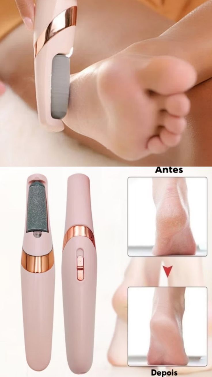 Electric Heel Callus Remover Foot File for Soft Smooth Feet